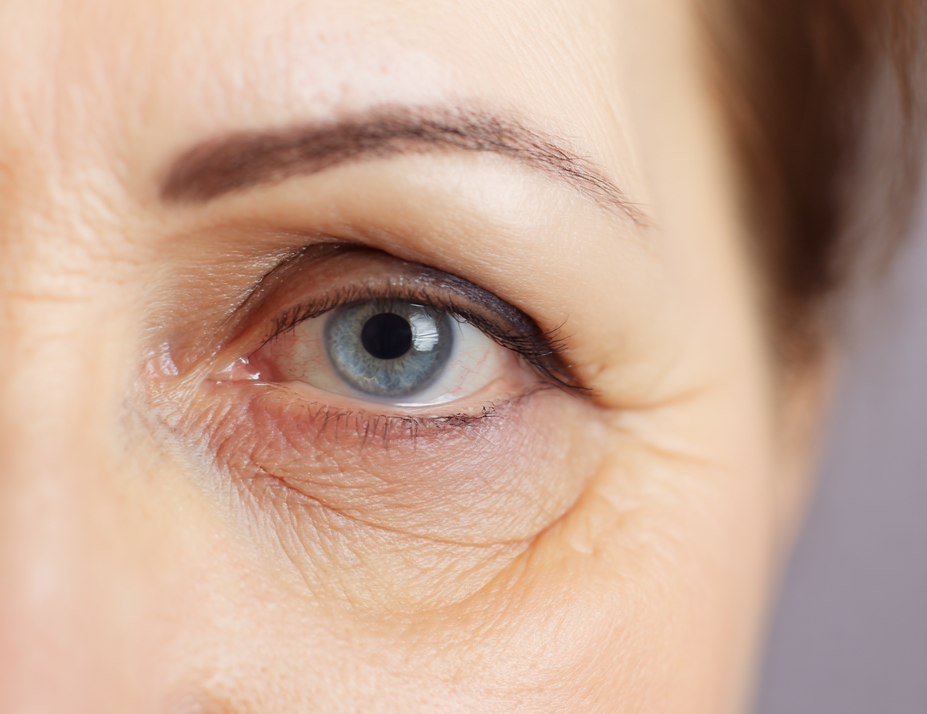 Czy lifting skroniowy jest dla Ciebie? – kryteria kwalifikacji pacjenta