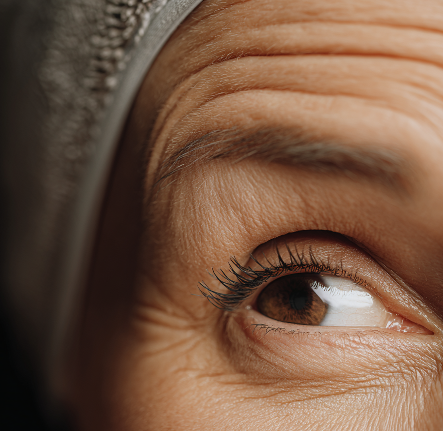 Zewnętrzna część brwi opada najszybciej – jak starzenie wpływa na oczy i co na to lifting skroniowy?